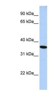 GTF2A1 / TFIIA Antibody (N-Terminus)