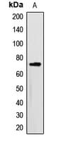 MTM1 / Myotubularin Antibody (Internal)