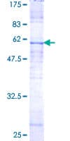 Human CYC1 / Cytochrome C-1 Protein (Recombinant GST)
