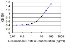 IHC-plus™ RHOE / RND3 Antibody (clone 1D2)
