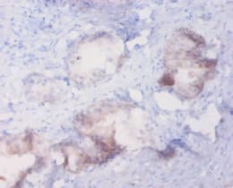 MT1A / Metallothionein 1A Antibody