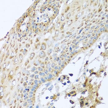 Polyclonal Rabbit anti-Human NDUFA2 Antibody (IHC, WB)