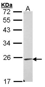 IHC-plus™ Polyclonal Rabbit anti-Human EMCN / Endomucin Antibody (aa4-206, IHC, WB)