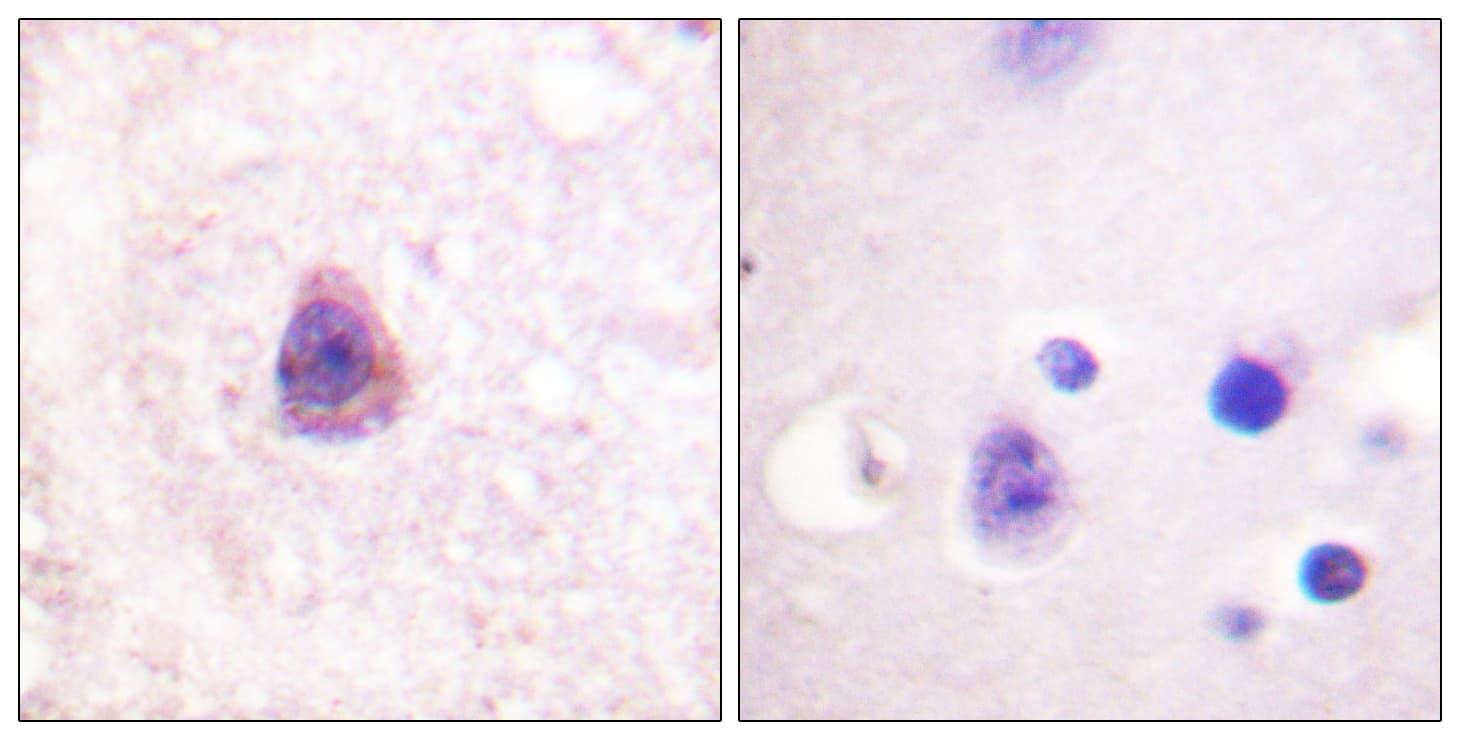 Polyclonal Rabbit anti-Human ARRB1 / Beta Arrestin 1 Antibody (aa369-418, IHC, IF, WB)