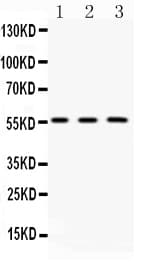 FGB / Fibrinogen Beta Chain Antibody