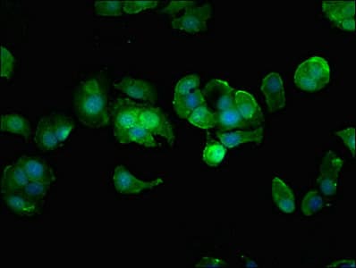 HIPK3 / FIST Antibody