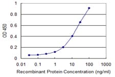 MLX / TCFL4 Antibody (clone 1C3)