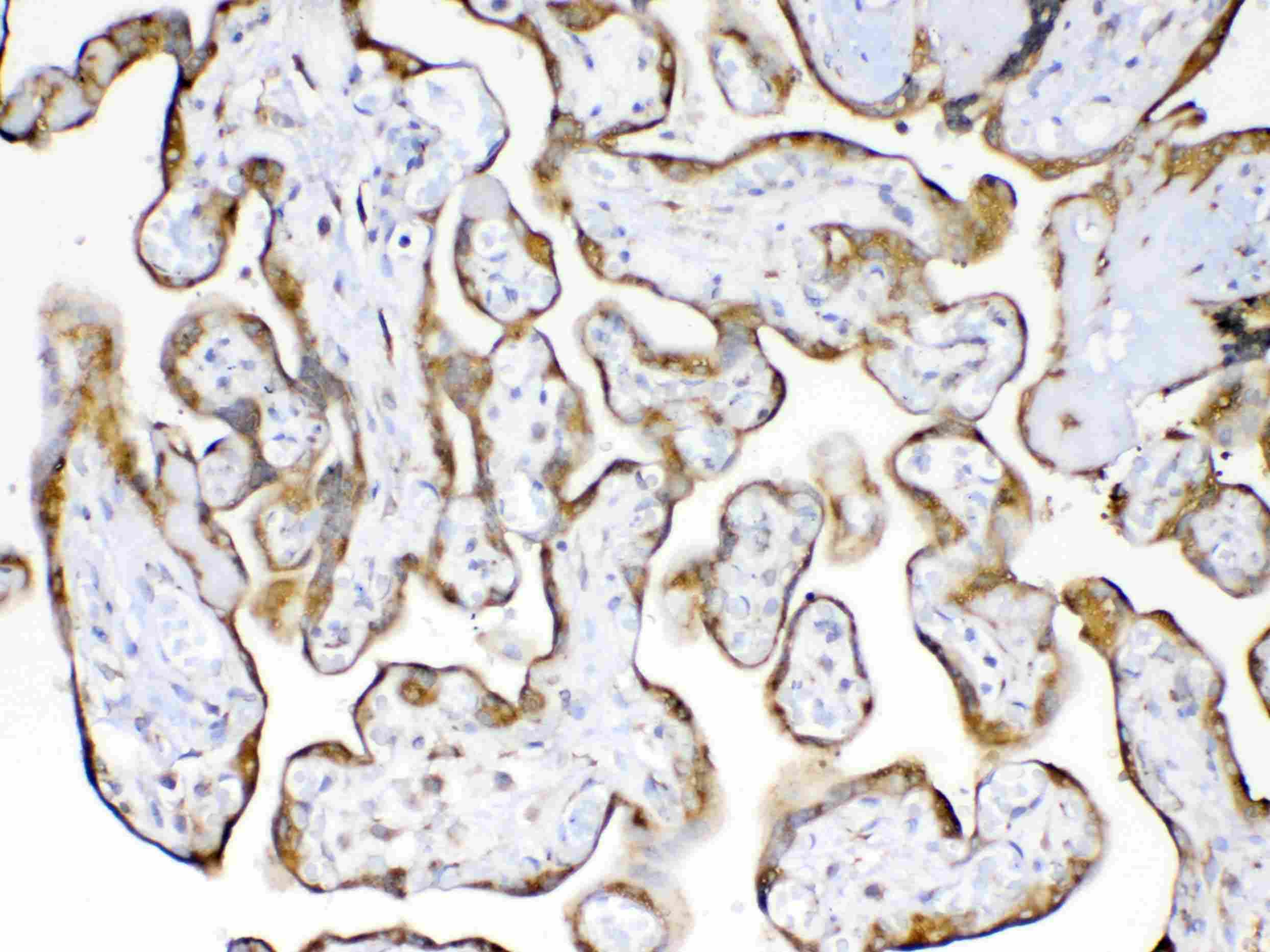 Polyclonal Rabbit anti-Human PPIB / Cyclophilin B Antibody (IHC, WB)