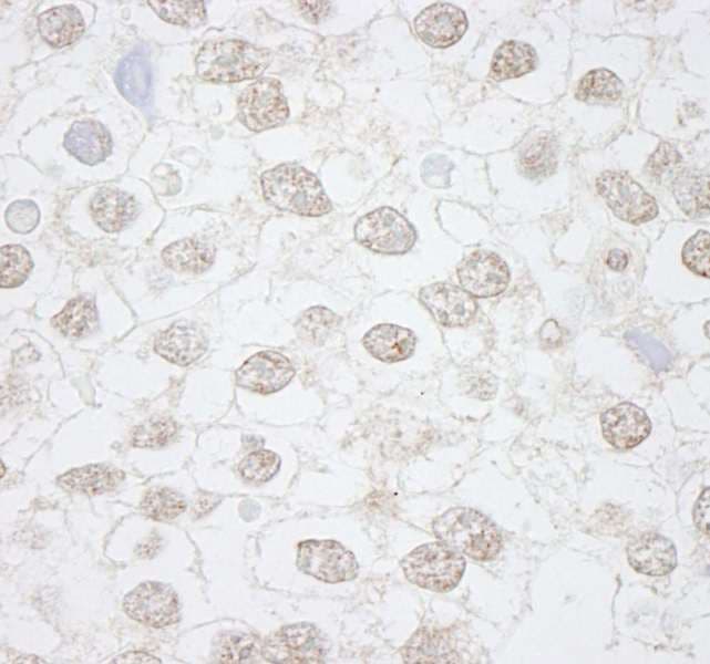 DMWD Antibody (aa609-659)