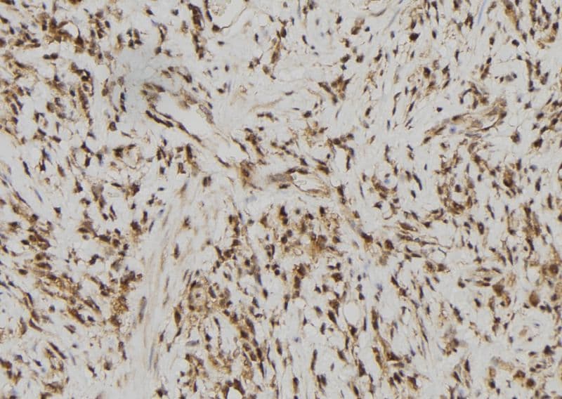 RFPL2 Antibody