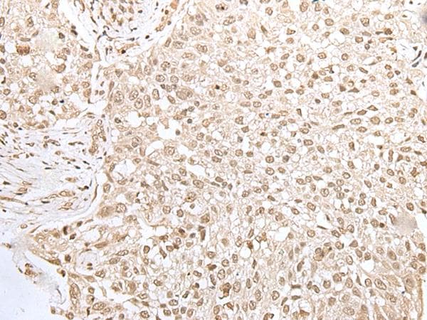 Polyclonal Rabbit anti-Human ZKSCAN3 / ZNF306 Antibody (IHC)