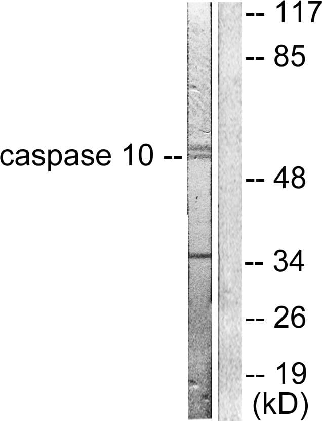 CASP10 / Caspase 10 Antibody (aa430-479)