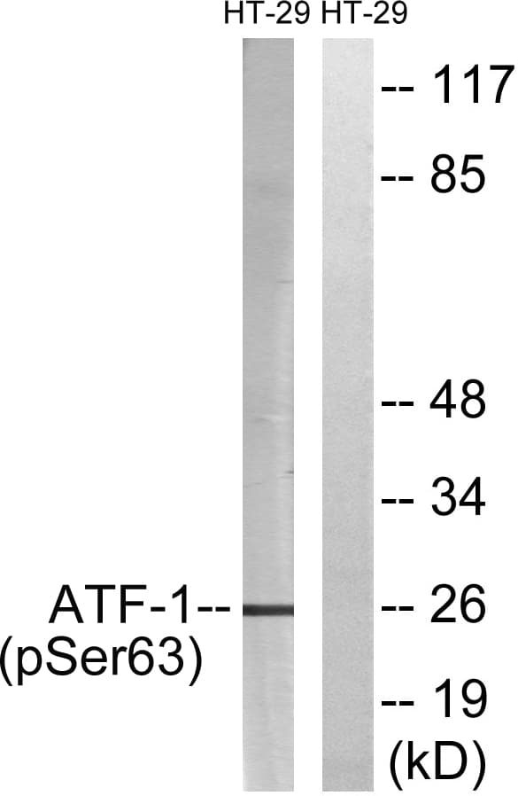 Polyclonal Rabbit anti-Human ATF1 Antibody (phospho-Ser63, WB)