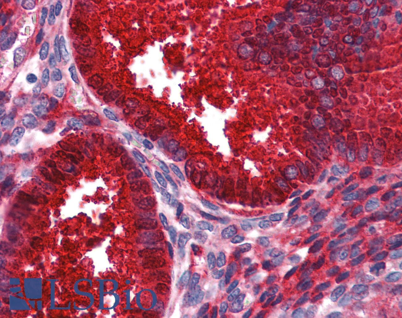 IHC-plus™ Monoclonal Mouse anti-Human SERPING1 / C1 Inhibitor Antibody (clone 3F4-1D9, IHC, WB)