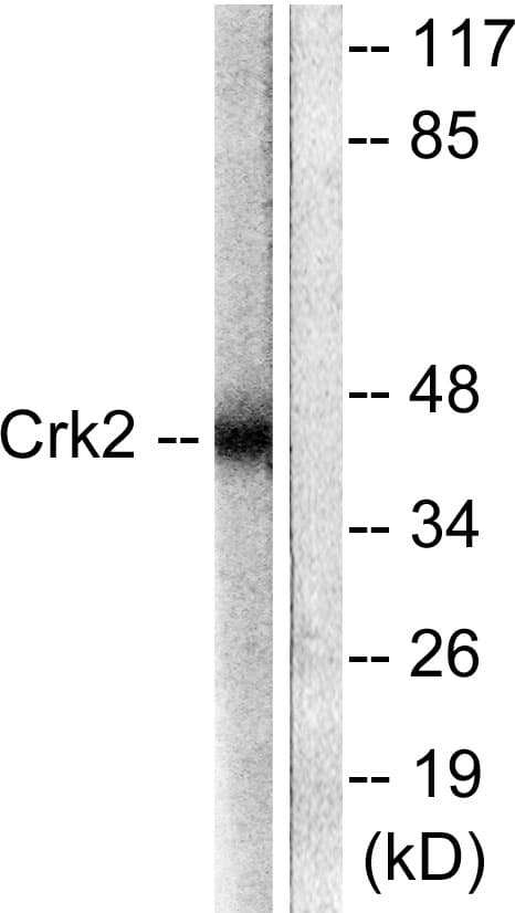 CRK Antibody (aa187-236)