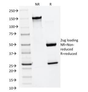 MMP2 Antibody (clone MMP2/1501)