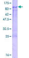 Human SNPH Protein (Recombinant GST)