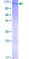 Human MCC Protein (Recombinant GST)
