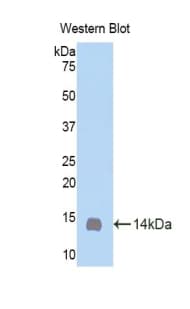 OSM / Oncostatin M Antibody (aa25-115, APC)