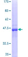Human RAB18 Protein (Recombinant GST)