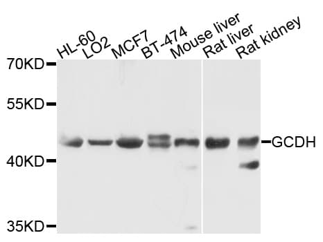 GCD / GCDH Antibody