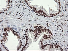 Monoclonal Mouse anti-Human SAE1 Antibody (clone 1G8, Carrier-free, IHC, IF, WB)