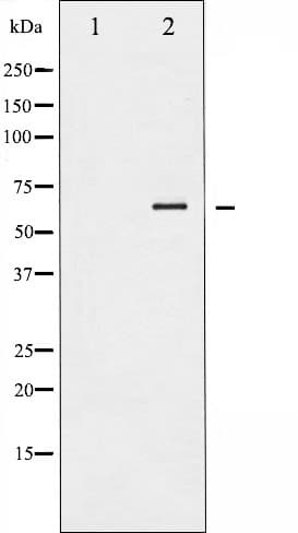 LIMK1 / LIMK Antibody