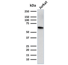 CD5 Antibody (clone CD5/2416)