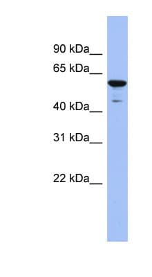 Polyclonal Rabbit anti-Human ZNF391 Antibody (aa35-84, WB)