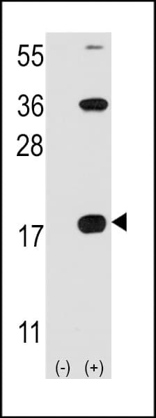Polyclonal Rabbit anti-Human CD247 / CD3 Zeta Antibody (aa113-141, WB)