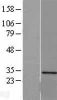 SERTAD1 / TRIP-Br1 / SEI-1 Protein (Over-Expression Lysate Myc-DDK (Flag))