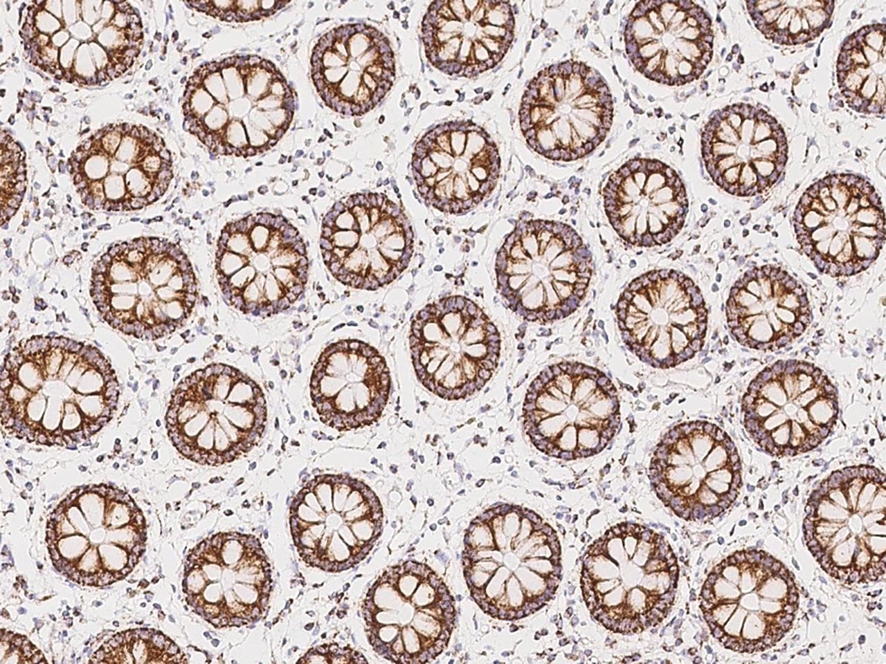 SUCLG1 / GALPHA Antibody (Preservative Free)