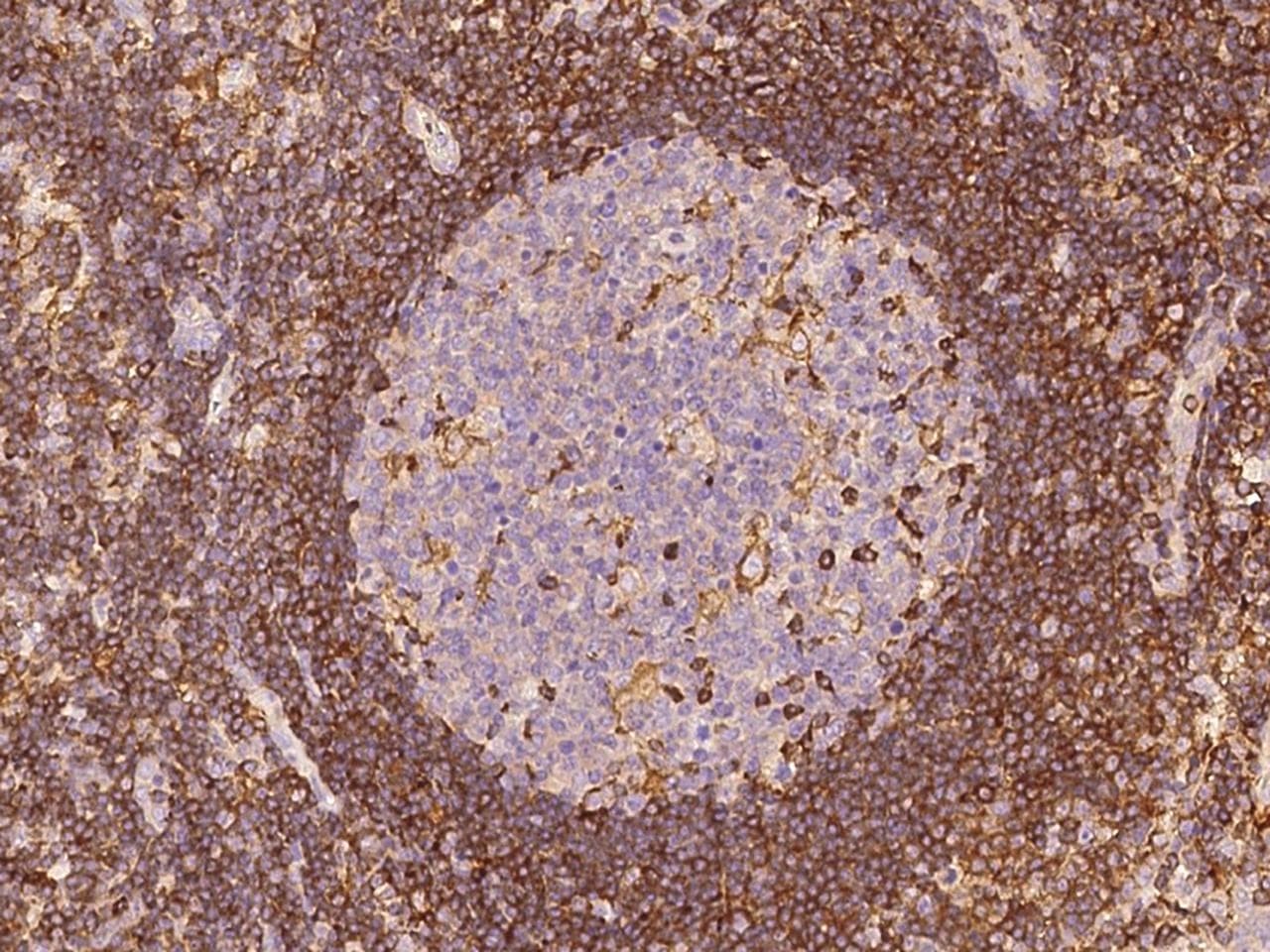 Polyclonal Rabbit anti-Human PD-L2 / PDCD1LG2 / CD273 Antibody (Preservative Free, IHC)