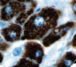 Monoclonal Mouse anti-Human Hepatocyte Specific Antigen Antibody (clone OCH1E5, Ready-to-Use, IHC)