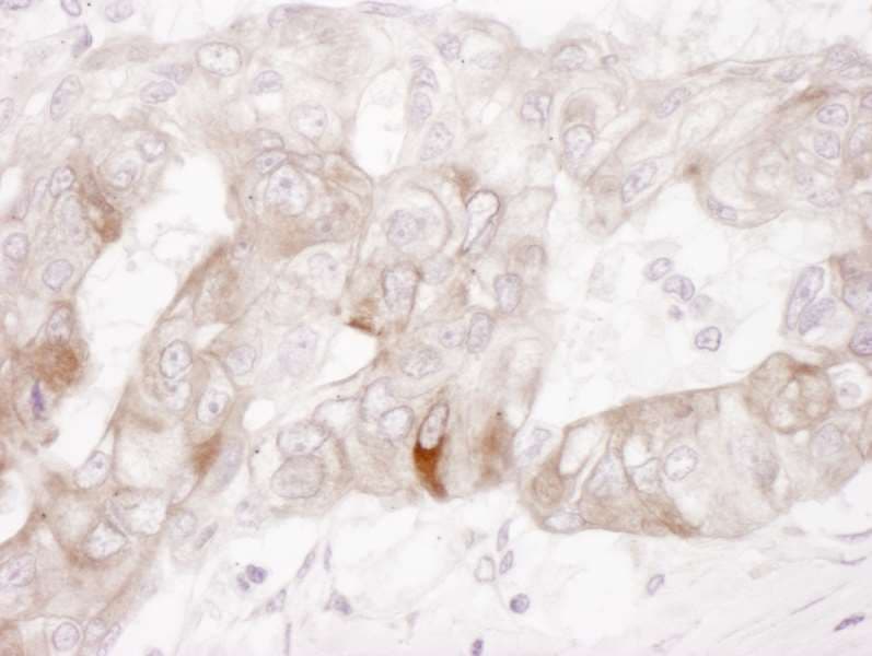 c-Kit / CD117 Antibody (aa925-976)