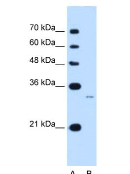 MUC3B Antibody (aa932-977)