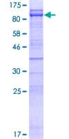 Human CEP76 Protein (Recombinant GST)