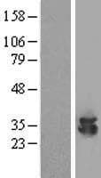ECH1 Protein (Over-Expression Lysate Myc-DDK (Flag))