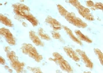 Basic Cytokeratin Antibody (clone KRTH/1076)