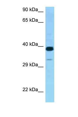 Polyclonal Rabbit anti-Human CRELD2 Antibody (aa135-184, WB)