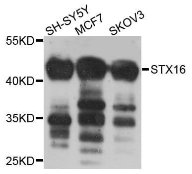 STX16 / Syntaxin 16 Antibody