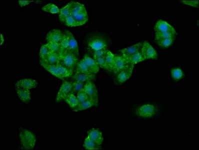NEB / Nebulin Antibody