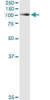 ACO1 / Aconitase Antibody (clone 2C1)