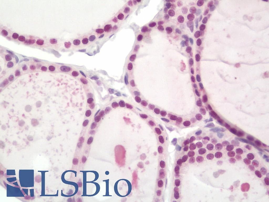 IHC-plus™ PALB2 Antibody (aa675-725)