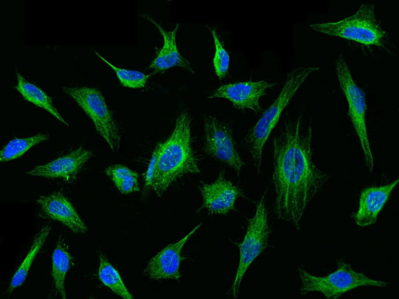 TUBB4 / Tubulin Beta 4 Antibody (Preservative Free)