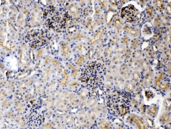 TNFRSF10B / Killer / DR5 Antibody