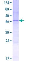 Human MANEAL Protein (Recombinant GST)