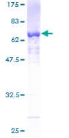 Human PRPF18 Protein (Recombinant GST)