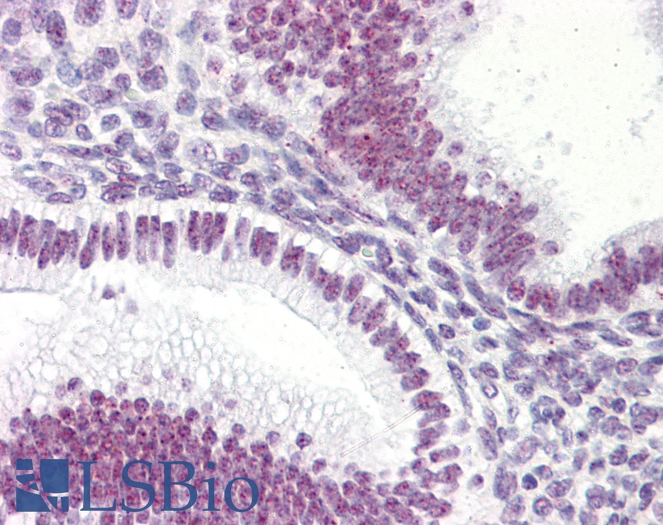 IHC-plus™ KLF4 Antibody (aa1-170, clone AT4E6)