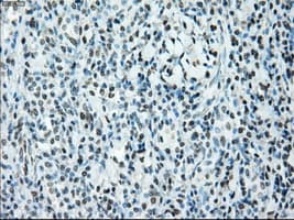 Monoclonal Mouse anti-Human BRAF / B-Raf Antibody (clone OTI4G6, IHC, WB)